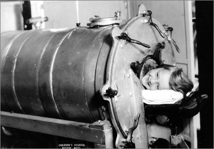 Η Dianne Odell σε μικρή ηλικία, ξαπλωμένη μέσα στον τεράστιο μεταλλικό κύλινδρο που καλύπτει ολόκληρο το σώμα της, εκτός από το κεφάλι